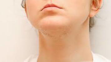 Treatments for Excessive Facial Hair - Eflora Cream